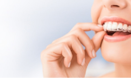 How Invisalign Treatment Can Improve Your Smile Without the Hassle of Braces